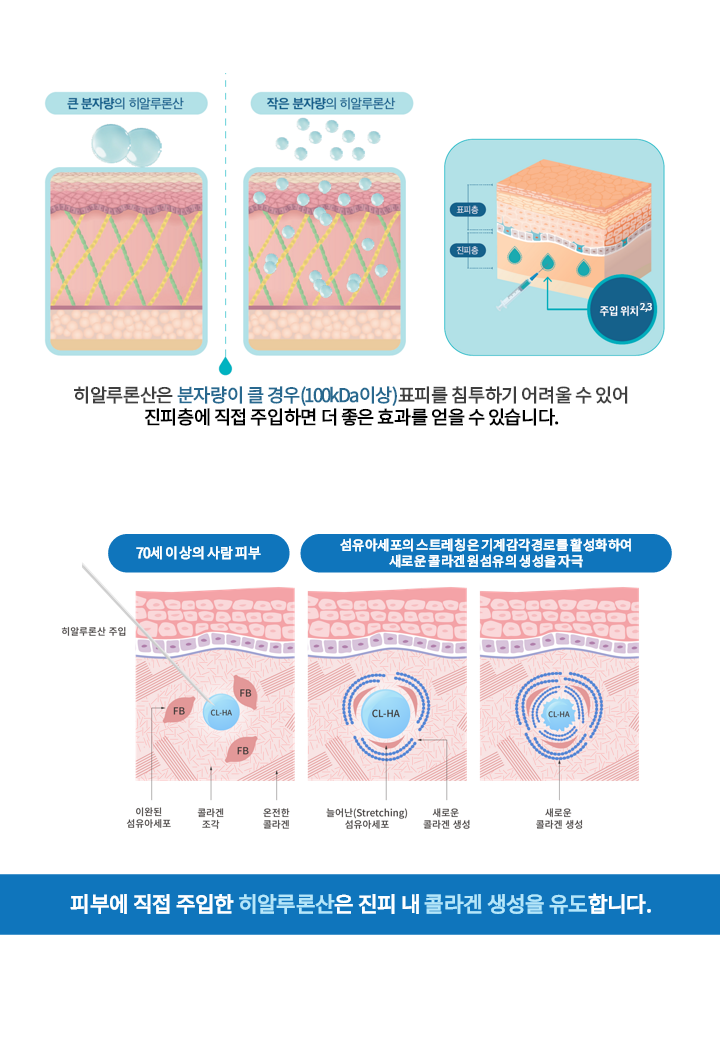 랜딩이미지